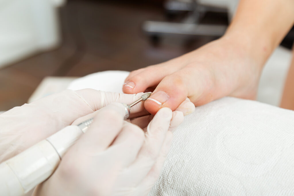 Pedicure ruso en Cuernavaca realizado con torno y técnica de precisión.